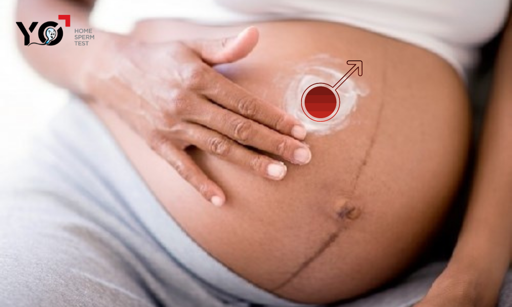 dấu hiệu mang thai con trai qua đường lông bụng
