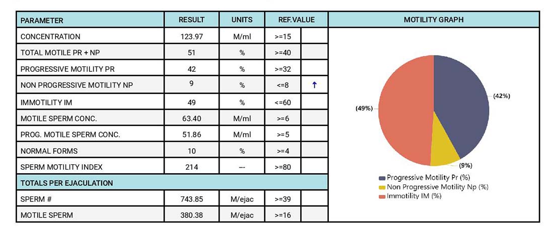 Results from semen analyzer SQA-iO