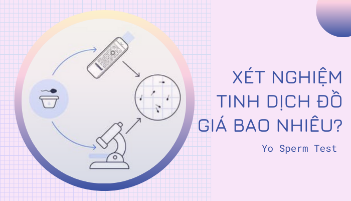 Xét nghiệm tinh dịch đồ giá bao nhiêu