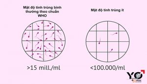 Tinh trùng ít
