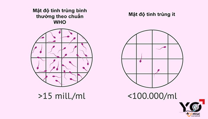 Tinh trùng ít