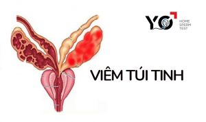 viem tui tinh la gi1