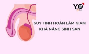 suy tinh hoan gay vo sinh