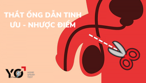 Thumbnail thắt ống dẫn tinh
