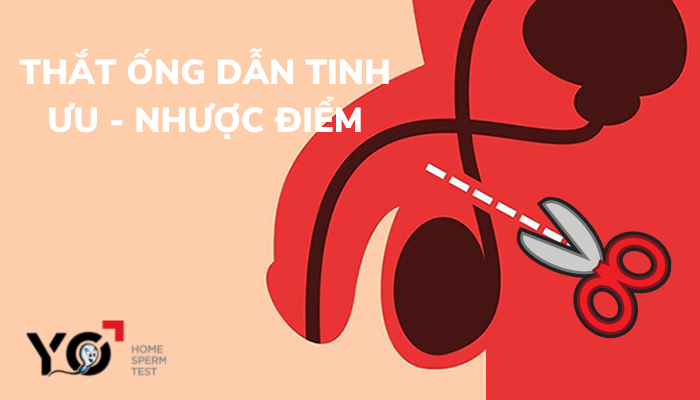 Thumbnail thắt ống dẫn tinh