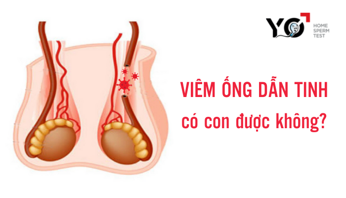 Viêm ống dẫn tinh