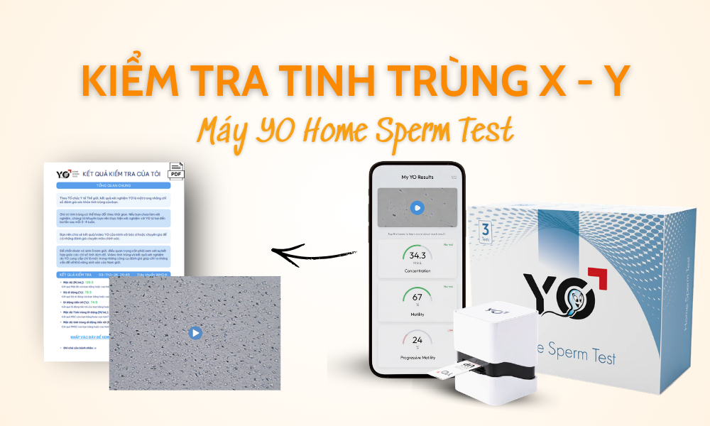 kiem tra tinh trung xy 2