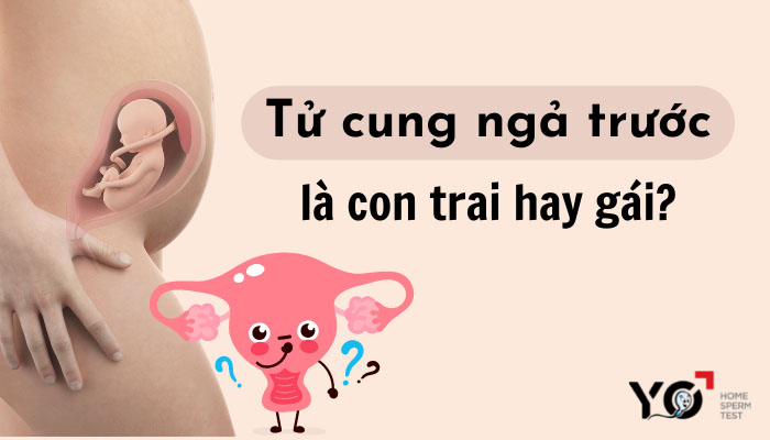 Tử cung ngả trước là con trai hay gái?