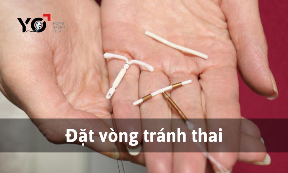 Tránh thai bằng phương pháp đặt vòng