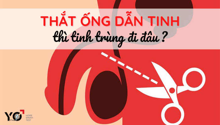 Thắt ống dẫn tinh thì tinh trùng đi đâu
