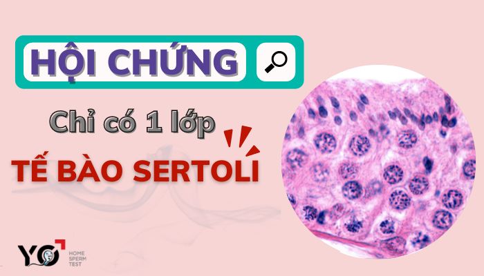 Hoi chung chi co mot lop te bao sertoli
